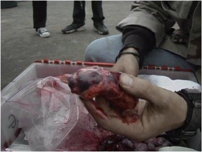 One condom that couldn't hold back disaster.