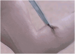 He stabbed an albino!