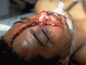 See What Happens When Yer Not Careful?